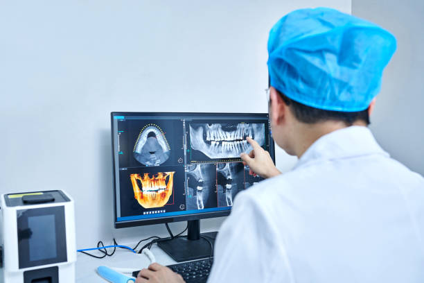 Best Emergency Wisdom Teeth Removal in Oakbrook Terrace, IL
